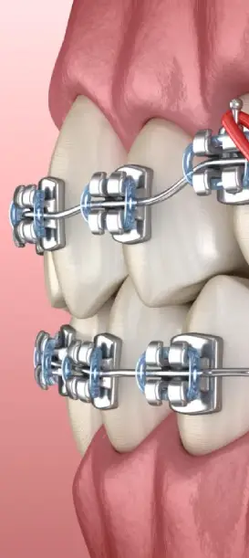 Dental consultation at Joseph's Dental & Aesthetic Wellness