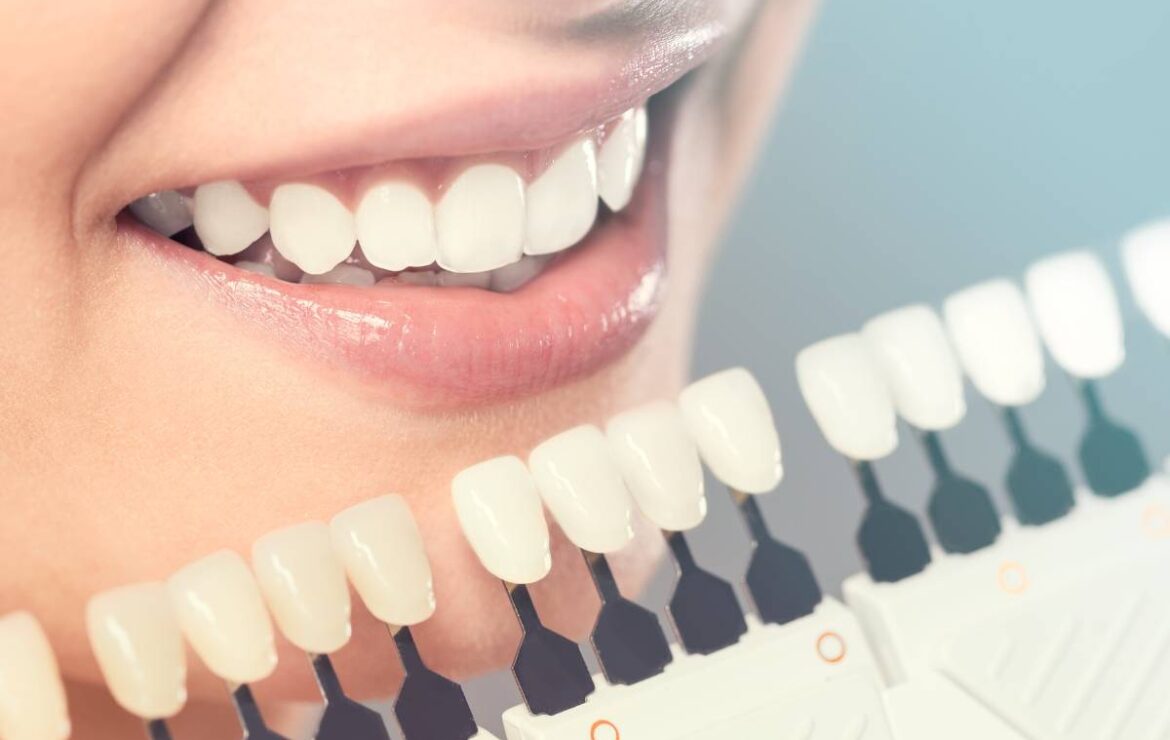 What are Cosmetic Dental Treatments?