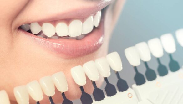 What are Cosmetic Dental Treatments?